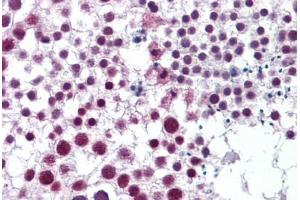 Human Testis: Formalin-Fixed, Paraffin-Embedded (FFPE) (Cyclin H 抗体  (AA 1-110))