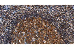 Immunohistochemistry of paraffin-embedded Human tonsil using GNA13 Polyclonal Antibody at dilution of 1:30 (GNA13 抗体)