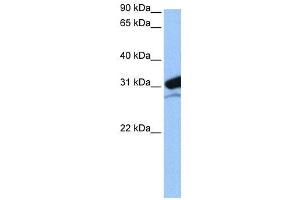 WB Suggested Anti-MRPL24  Antibody Titration: 0. (MRPL24 抗体  (N-Term))