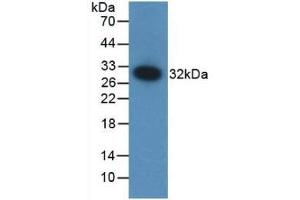 Detection of Recombinant F12, Mouse using Polyclonal Antibody to Coagulation Factor XII (F12) (F12 抗体  (AA 352-587))