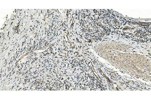 IHC analysis of FLCN using anti-FLCN antibody (ABIN7602491). (FLCN 抗体  (AA 8-551))