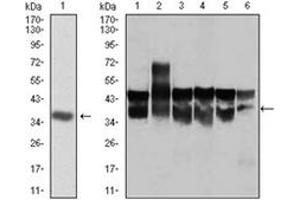 Western Blotting (WB) image for anti-Cyclin-Dependent Kinase 2 (CDK2) antibody (ABIN1106645) (CDK2 抗体)