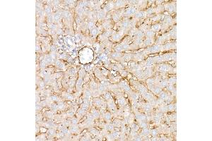 Immunohistochemistry of paraffin-embedded human tonsil using CD81 Rabbit pAb (ABIN6134776, ABIN6138231, ABIN6138232 and ABIN6220897) at dilution of 1:50 (40x lens).