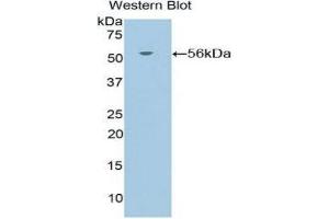 Western Blotting (WB) image for anti-Nuclear Receptor Subfamily 3, Group C, Member 1 (Glucocorticoid Receptor) (NR3C1) (AA 532-730) antibody (ABIN1860047) (Glucocorticoid Receptor 抗体  (AA 532-730))