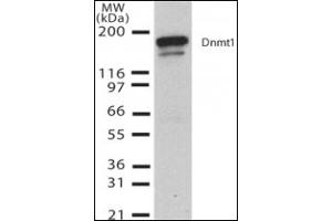 Western Blotting (WB) image for anti-DNA (Cytosine-5)-Methyltransferase 1 (DNMT1) (AA 637-650) antibody (ABIN492452) (DNMT1 抗体  (AA 637-650))