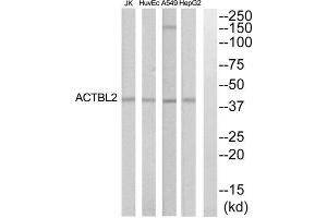 Western blot analysis of extracts from HepG2, HuvEc, Jurkat and A549 cells, using ACTBL2 antibody. (ACTBL2 抗体  (Internal Region))