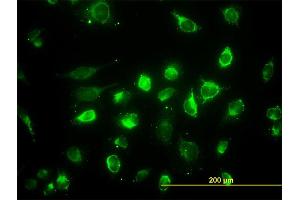 Immunofluorescence of monoclonal antibody to ACAA2 on HeLa cell. (ACAA2 抗体  (AA 151-260))