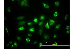 Immunofluorescence of monoclonal antibody to ACAA2 on HeLa cell.