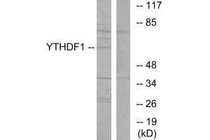 Western blot analysis of extracts from 293 cells, using YTHDF1 antibody. (YTHDF1 抗体  (N-Term))