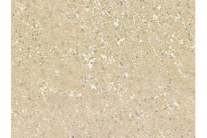 ABIN6261946 and ABIN6276589 at 1/100 staining human pituitary adenoma by IHC-P.
