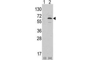 Western blot analysis of APPBP1 (arrow) using rabbit polyclonal APPBP1 Antibody (C-term) (AP13996PU-N ). (NAE1 抗体  (C-Term))