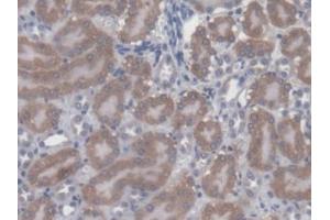 DAB staining on IHC-P; Samples: Mouse Kidney Tissue (CBY1/PGEA1 抗体  (AA 7-127))