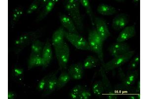 Immunofluorescence of monoclonal antibody to S100B on HeLa cell . (S100B 抗体  (AA 1-92))