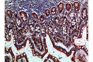 Immunohistochemical analysis of paraffin-embedded human-small-intestine, antibody was diluted at 1:200 (BTLA 抗体  (AA 101-150))