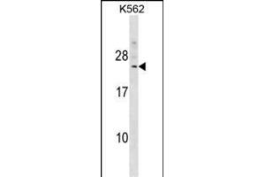 DCAKD Antibody (N-term) (ABIN1539435 and ABIN2849301) western blot analysis in K562 cell line lysates (35 μg/lane). (DCAKD 抗体  (N-Term))