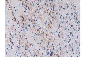 Immunohistochemistry (IHC) image for anti-Ornithine Decarboxylase 1 (ODC1) (AA 15-259) antibody (ABIN7433486)