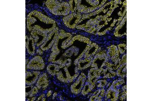Immunofluorescence (IF) image for anti-Catenin, beta (CATNB) (AA 725-775) antibody (ABIN7455205)