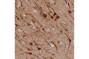 Immunohistochemical staining of human cerebral cortex with MCCD1 polyclonal antibody  shows strong cytoplasmic positivity in neuronal cells at 1:20-1:50 dilution. (MCCD1 抗体)