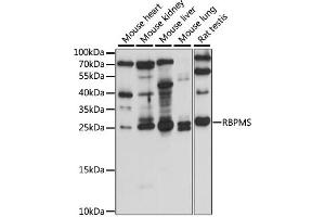 Western blot analysis of extracts of various cell lines, using RBPMS antibody (ABIN7270097) at 1:1000 dilution. (RBPMS 抗体  (AA 110-219))