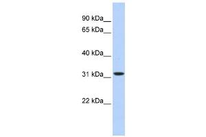 Western Blotting (WB) image for anti-3-hydroxyisobutyrate Dehydrogenase (HIBADH) antibody (ABIN2459627) (HIBADH 抗体)