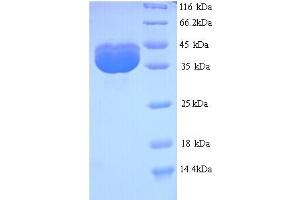 SDS-PAGE (SDS) image for VP2 (AA 2-344) protein (His tag) (ABIN5714156) (VP2 (AA 2-344) protein (His tag))