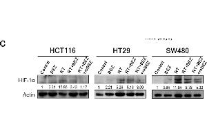 BEZ235 maintenance treatment following RT + BEZ235 treatment sensitized CRC cells to radiation by attenuating mTOR signaling- and angiogenesis-associated molecules. (Actin, gamma 1 抗体  (N-Term))