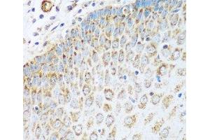 Immunohistochemistry of paraffin-embedded Human esophagus using GLUD1 Polyclonal Antibody at dilution of 1:100 (40x lens). (GLUD1 抗体)