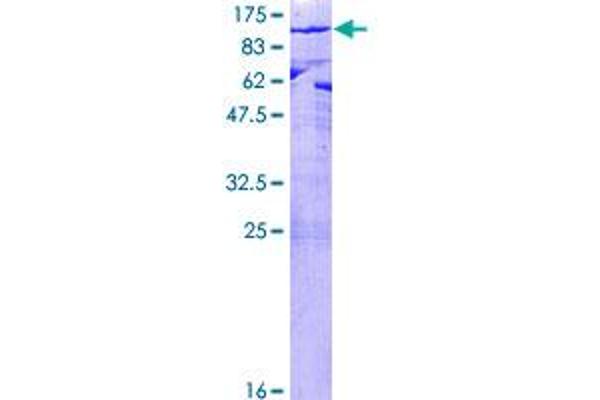 MPP5 Protein (AA 1-675) (GST tag)