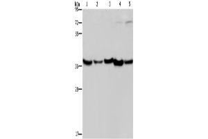 Western Blotting (WB) image for anti-DnaJ (Hsp40) Homolog, Subfamily B, Member 4 (DNAJB4) antibody (ABIN2423323) (DNAJB4 抗体)