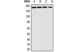Western blot analysis of EIF3A expression in HepG2 (A), Jurkat (B), mouse heart (C), mouse ovary (D) whole cell lysates. (EIF3A 抗体)