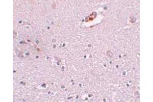 Immunohistochemical staining of human brain tissue with 5 ug/mL ZNF536 polyclonal antibody .