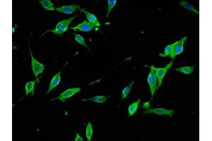 Immunofluorescence staining of NIH/3T3 cells with ABIN7171124 at 1:133, counter-stained with DAPI. (Synaptojanin 1 抗体  (AA 1030-1261))
