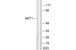 Western blot analysis of extracts from NIH/3T3cells, treated with PDGF (50mg /ml, 20mins), using Akt (epitope around residue 124) Antibody. (AKT1 抗体  (Ser124))