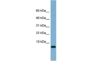 WB Suggested Anti-FABP1 Antibody Titration:  0. (FABP1 抗体  (N-Term))