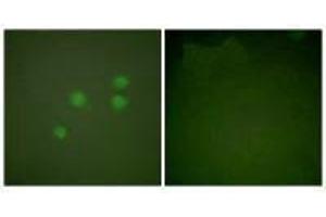 Immunofluorescence analysis of A549 cells, using Cyclin E1 antibody. (Cyclin E1 抗体)