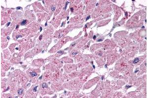 Human Heart (formalin-fixed, paraffin-embedded) stained with CYSLTR2 antibody ABIN213376 at 10 ug/ml followed by biotinylated goat anti-rabbit IgG secondary antibody ABIN481713, alkaline phosphatase-streptavidin and chromogen. (CasLTR2 抗体  (Extracellular Domain))