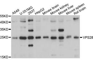Western blot analysis of extracts of various cells, using VPS28 antibody. (VPS28 抗体)