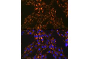 Immunofluorescence analysis of C6 cells using PUMA Rabbit mAb (ABIN1678790, ABIN3018050, ABIN3018051 and ABIN7101572) at dilution of 1:100 (40x lens).