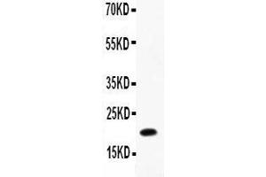 Anti-IL12 p40 Picoband antibody,  All lanes: Anti-IL12 P40 at 0. (IL12B 抗体  (AA 23-321))