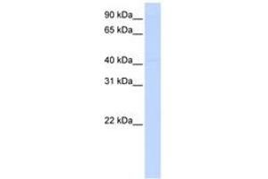 Image no. 1 for anti-Excision Repair Cross-Complementing Rodent Repair Deficiency, Complementation Group 8 (ERCC8) (AA 216-265) antibody (ABIN6744221)