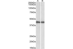 AP22441PU-N IDH1 antibody staining of Mouse (A) and Rat (B) Liver lysates at 0. (Isocitrate Dehydrogenase 抗体  (Internal Region))