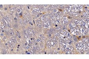 Detection of NPS in Rat Spinal cord Tissue using Polyclonal Antibody to Neuropeptide S (NPS) (NPS 抗体  (AA 26-89))