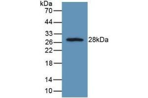 Detection of Recombinant FGFRL1, Rat using Polyclonal Antibody to Fibroblast Growth Factor Receptor Like Protein 1 (FGFRL1)