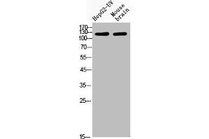Western Blot analysis of HepG2-UVmouse brain cells using Acetyl-CRM1 (K568) Polyclonal Antibody (XPO1 抗体  (acLys568))