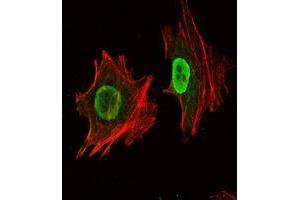 Immunofluorescence analysis of NTERA-2 cells using Oct4 mouse mAb (green). (OCT4 抗体)