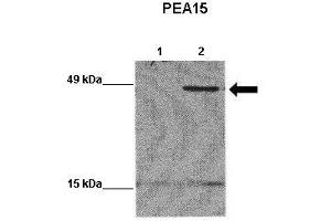 WB Suggested Anti-PEA15 Antibody    Positive Control:  Lane 1: 20ug EGFP-transfected MCF7 lysate Lane 2: 20ug EGFP-PEA15 transfected MCF7 lysate   Primary Antibody Dilution :   1:1000  Secondary Antibody :  Goat anti-rabbit-HRP   Secondry Antibody Dilution :   1:5000  Submitted by:  Yann Wallez (Sanford-Burnham Medical Research Institute) (PEA15 抗体  (Middle Region))