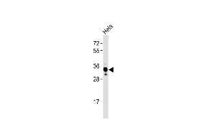 Anti-DKK1 Antibody at 1:4000 dilution + Hela whole cell lysates Lysates/proteins at 20 μg per lane.