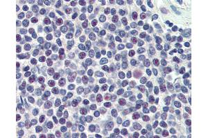 Anti-HMG20A antibody IHC of human spleen. (HMG20A 抗体  (AA 336-347))