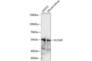 Western blot analysis of extracts of various cell lines, using SLC2 antibody (ABIN7270416) at 1:1000 dilution. (SLC2A9 抗体  (AA 400-500))