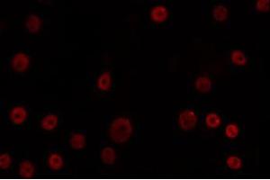 ABIN6266690 staining K562 by IF/ICC. (OVOL1 抗体  (N-Term))